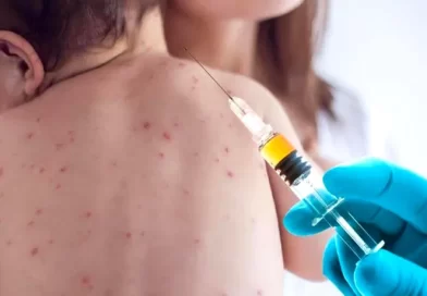 Batut: Od početka godine u Novom Pazaru registrovano 95 slučajeva malih boginja