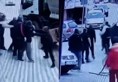 Tuča u centru Sjenice: Emir Lakota tvrdi da je napadnut zbog kritike radova na ulici kod Toplane